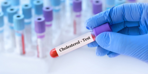 Cholesterol Levels Test