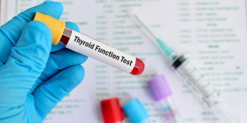 Thyroid Function Test