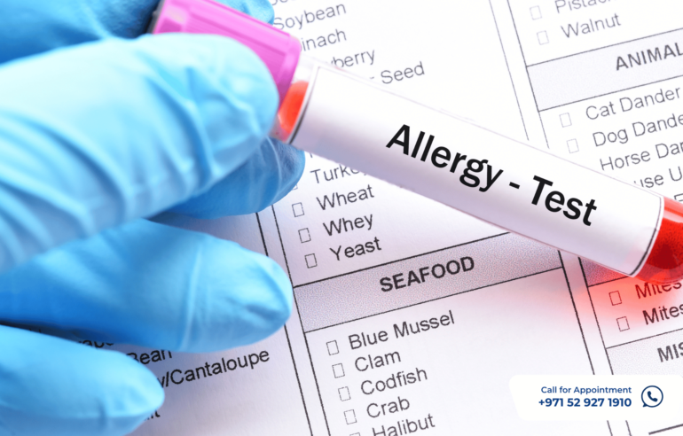 Allergy Test at Home in Dubai