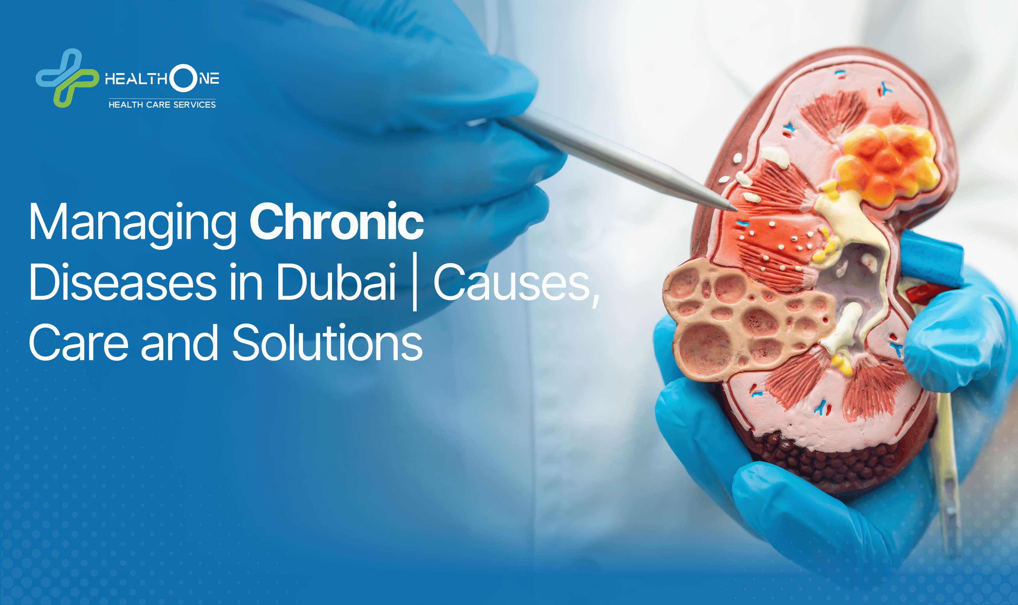 Managing Chronic Diseases in Dubai _ Causes, Care and Solutions