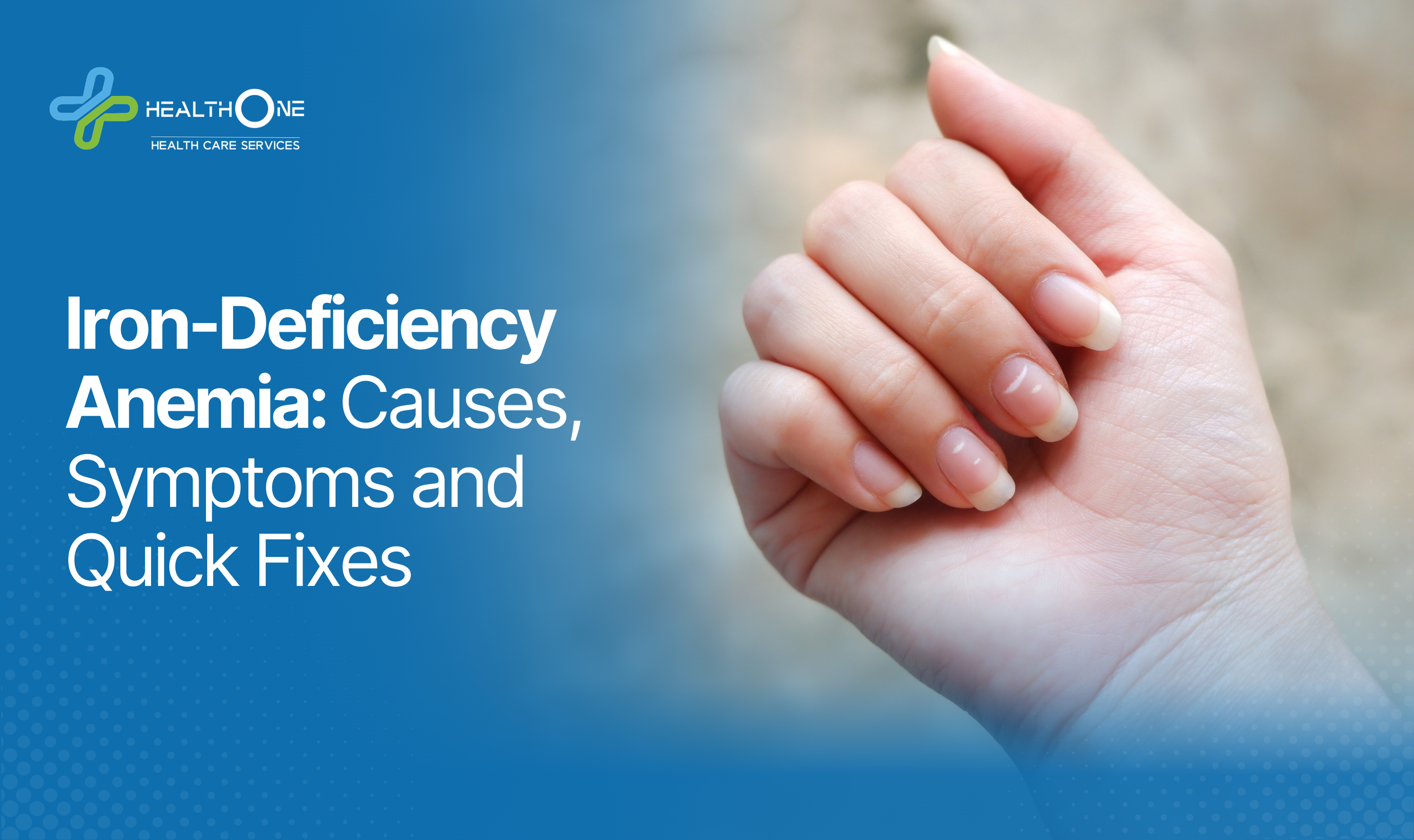 Iron-Deficiency Anemia_ Causes, Symptoms and Quick Fixes